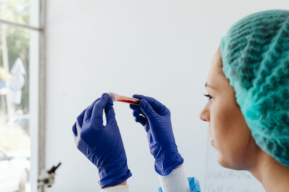 Do You Need Fasting Before TRT Blood Work?