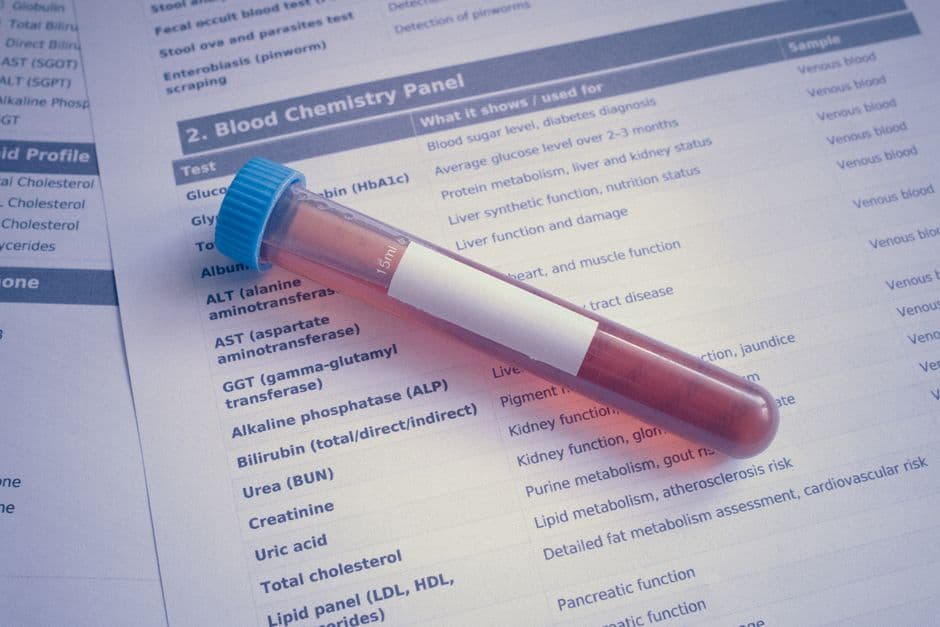 How to Prepare for Blood Work: Fasting, Supplements, and What to Expect