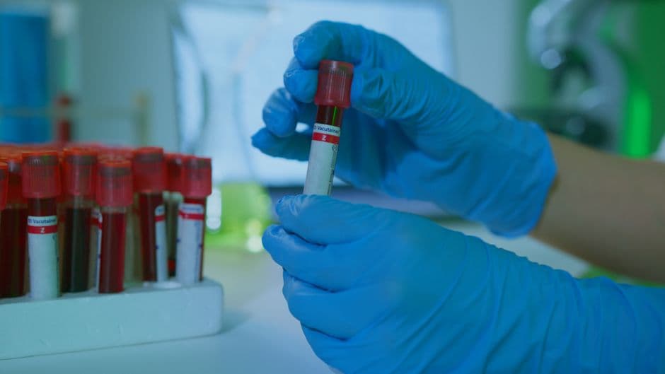 What Blood Tests Might a Functional Medicine Provider Order?