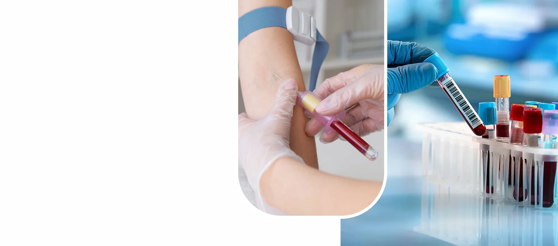 Mobile Blood Draw Service The Villages and Bushnell FL