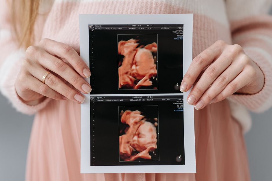 Peekaboo Gender Test vs Ultrasound: Which Is More Accurate?