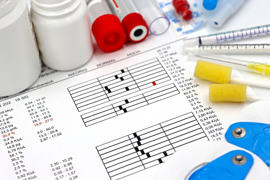 Thyroid Blood Tests Explained: Understanding TSH, Free T4, and Thyroid Antibodies -