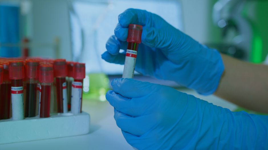 What Blood Tests Might a Functional Medicine Provider Order?
